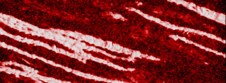 AFM Phase Image of Polymer Blend